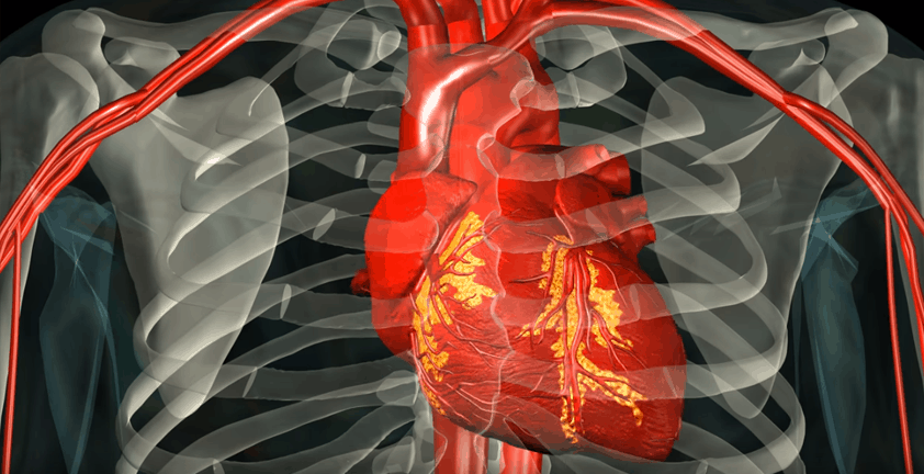 Heart Arrhythmia 3D Animation