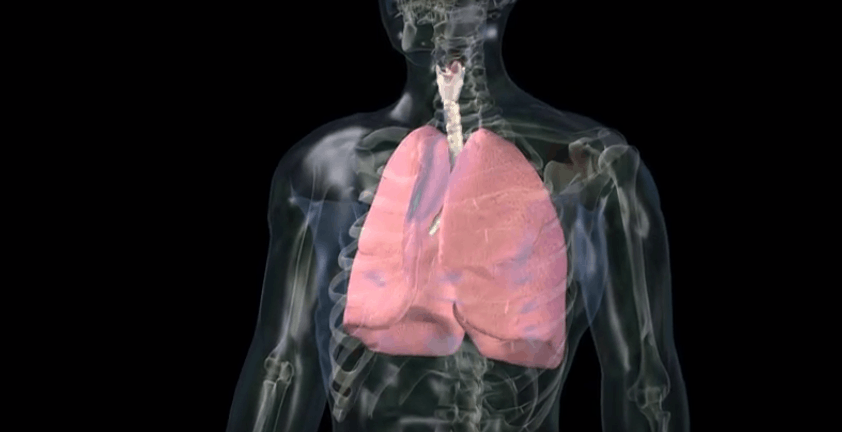 Asthma Attack 3D Visualization Animation