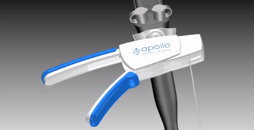 Medical Device 3D Animation Overstitch Assembly | Endoscopic Operation Device
