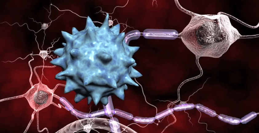 Multiple Sclerosis 3D Visualization